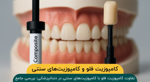 تفاوت-کامپوزیت-فلو-کامپوزیت‌-های-سنتی